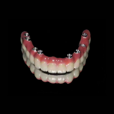 Dental Implants Company