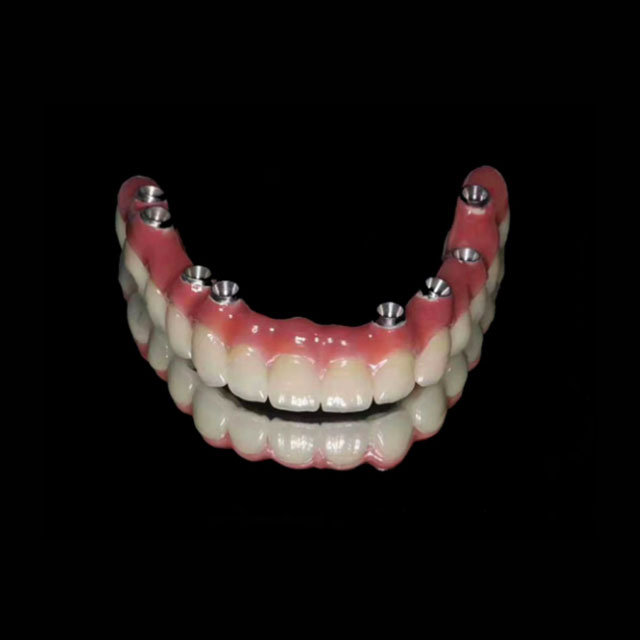 Dental Implants Company