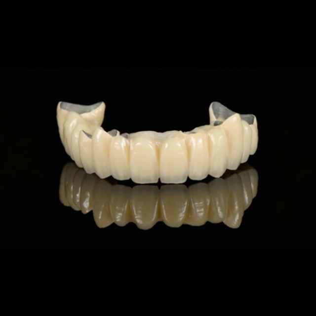 China Porcelain Fused to Metal Manufacturing Service