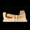 Dental Implants Company