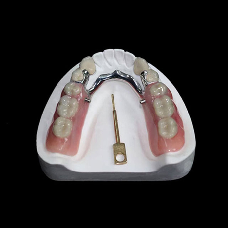 China Precision Attachments Manufacturing Service