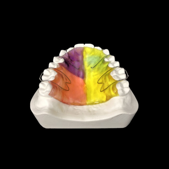 China Dental Retainers Manufacturing Service