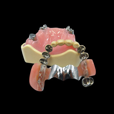 China Telescope Case Manufacturing Service