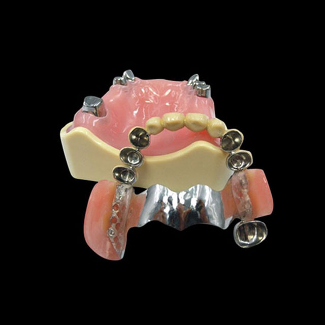 China Telescope Case Manufacturing Service