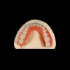 China Acrylic Denture Manufacturing Service