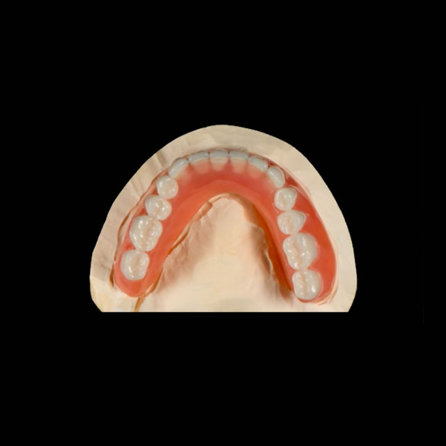 China Acrylic Denture Manufacturing Service