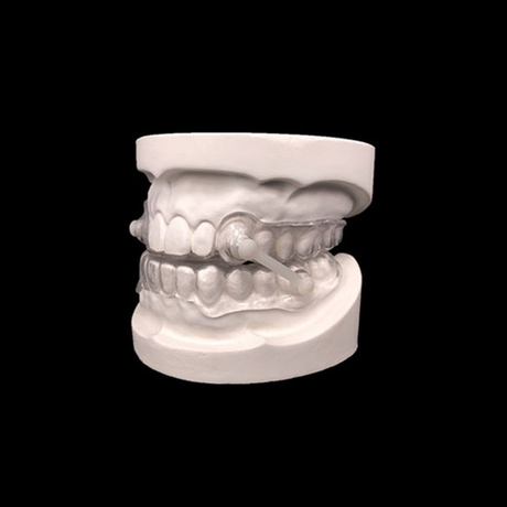 China Anti-snoring Appliance Manufacturing Service