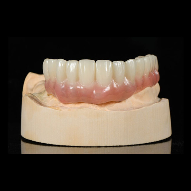 China Temporary Teeth Manufacturing Service