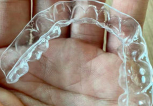Do clear aligners really work in all cases?