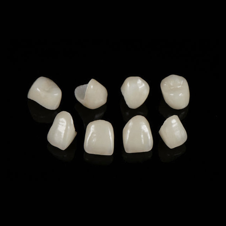 China Emax Crowns Manufacturing Service