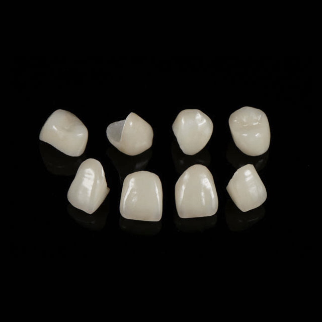 China Emax Crowns Manufacturing Service