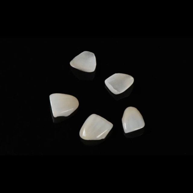 China Veneers Manufacturing Service