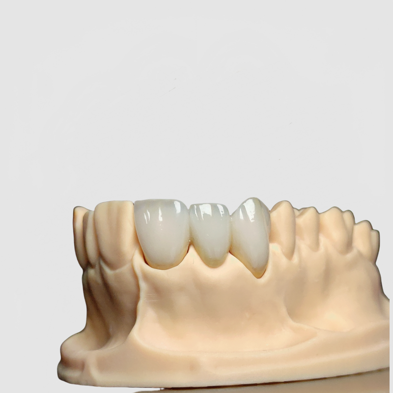 Zirconia Crowns Manufacturer