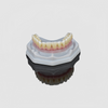 Implant Titanium Bar