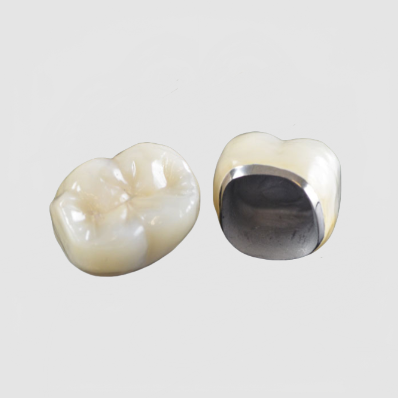 China Porcelain Fused to Metal Manufacturing Service