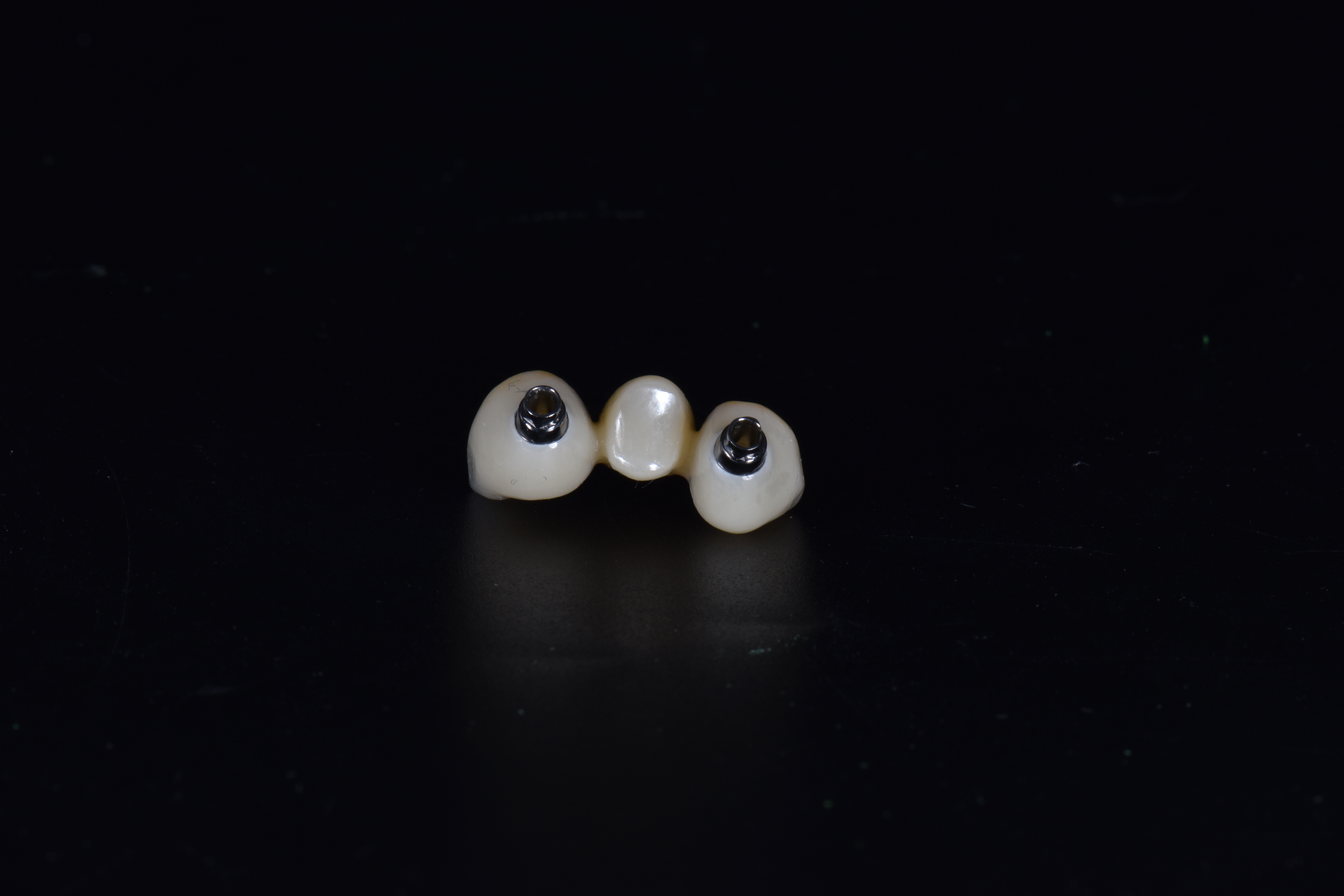 Dental Implants Company