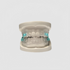 China Anti-snoring Appliance Manufacturing Service