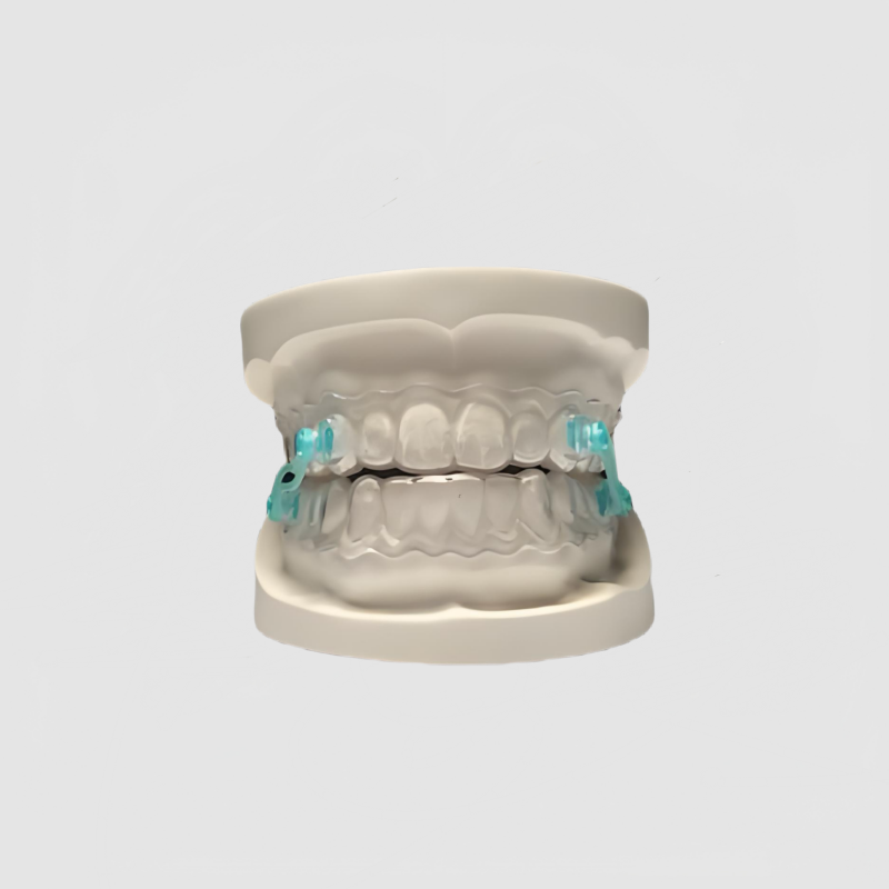 China Anti-snoring Appliance Manufacturing Service