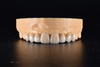 China Emax Crowns Manufacturing Service
