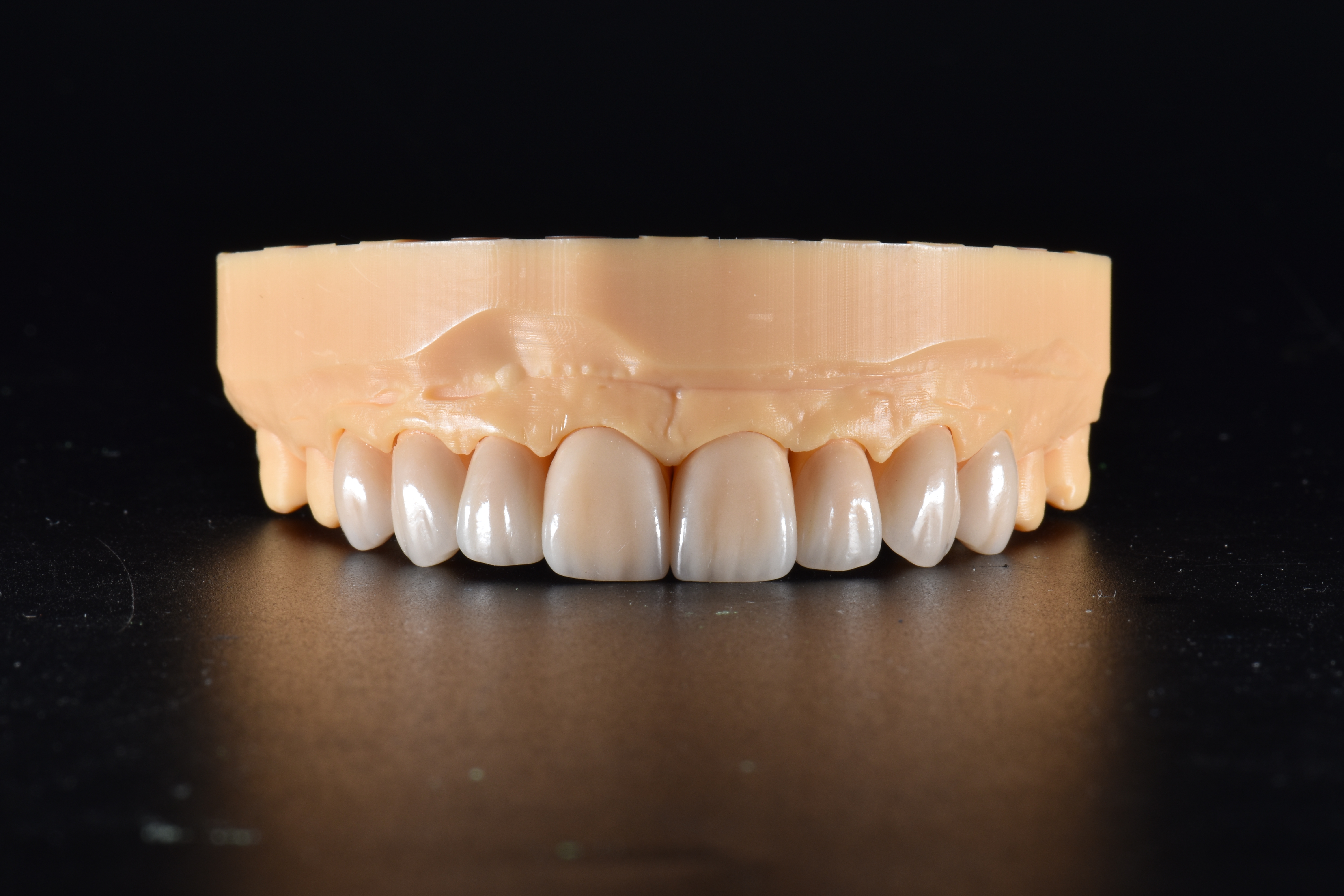 China Emax Crowns Manufacturing Service