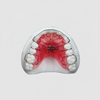 China Dental Retainers Manufacturing Service
