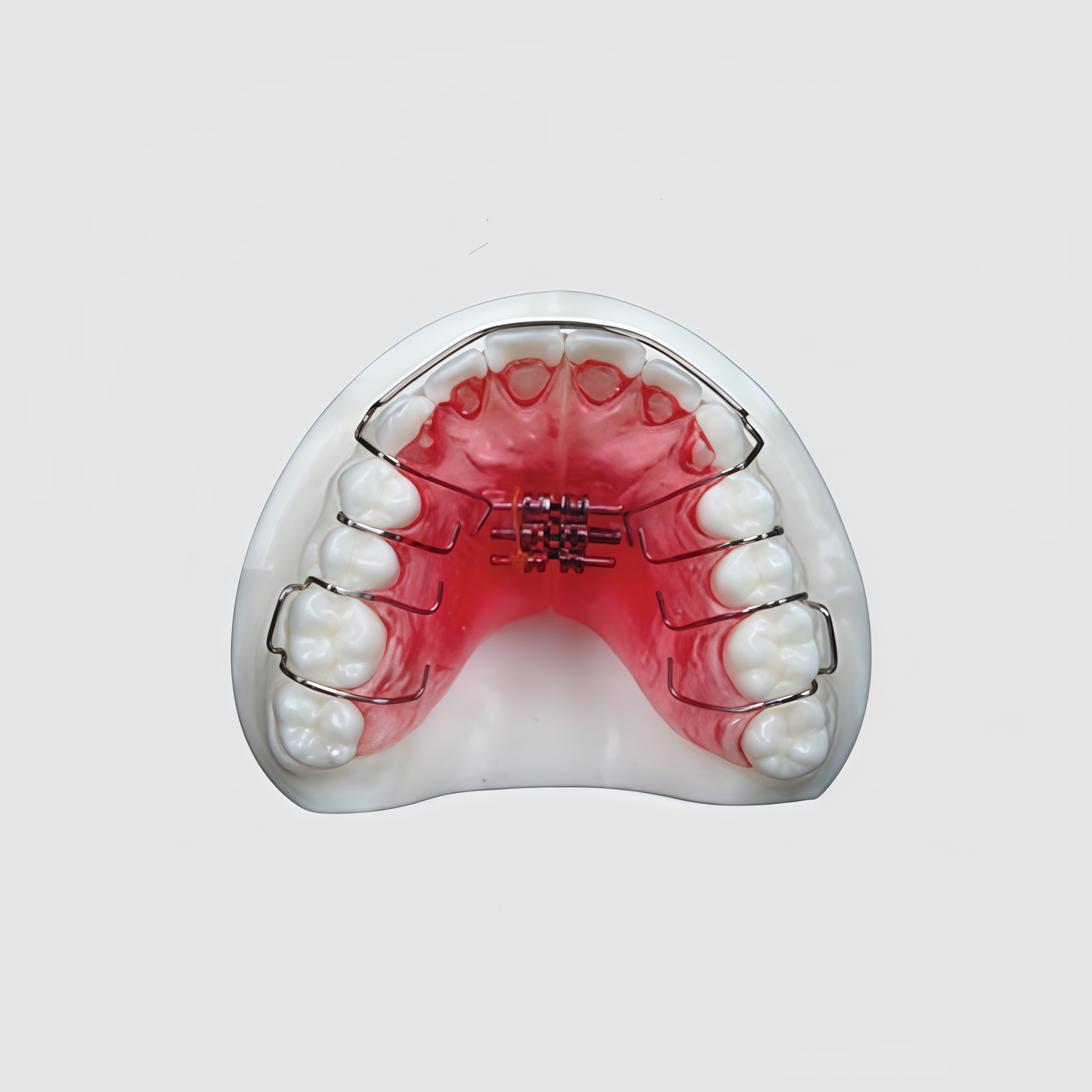 China Dental Retainers Manufacturing Service