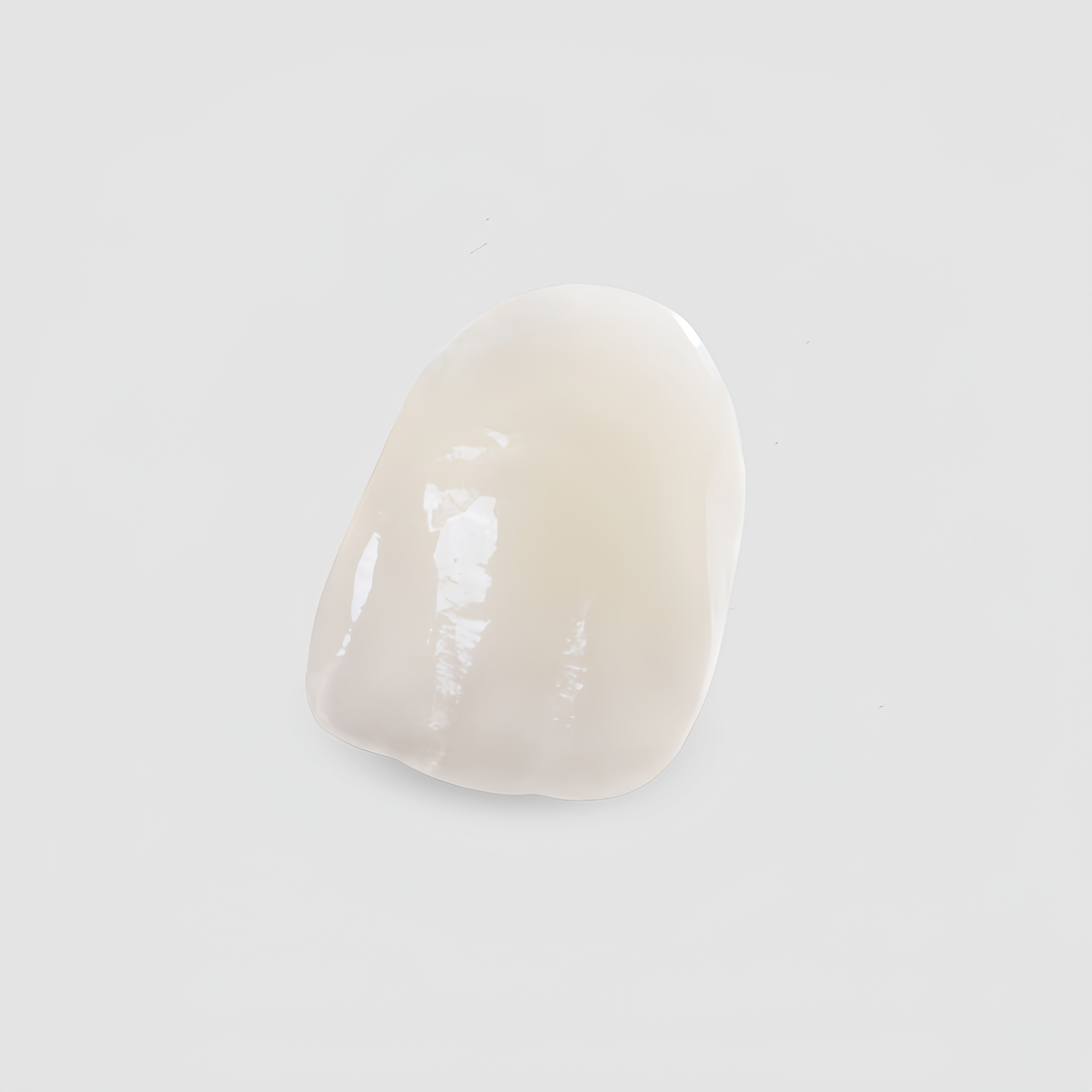 China Veneers Manufacturing Service