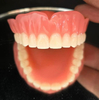 China Acrylic Denture Manufacturing Service