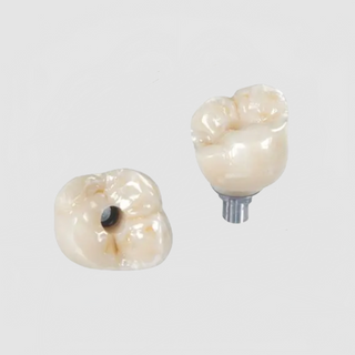 Dental Implants Company