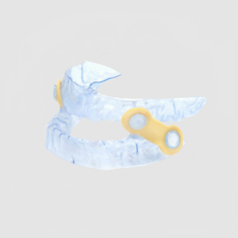China Anti-snoring Appliance Manufacturing Service