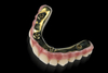 Implant Titanium Bar