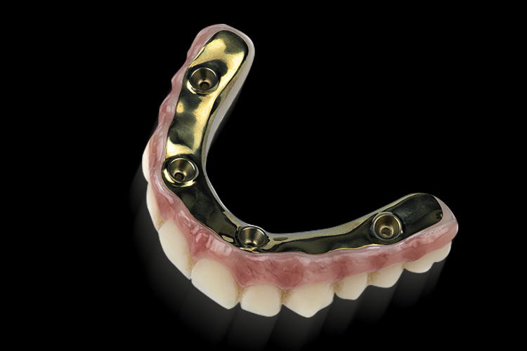 Implant Titanium Bar
