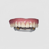 Implant Titanium Bar