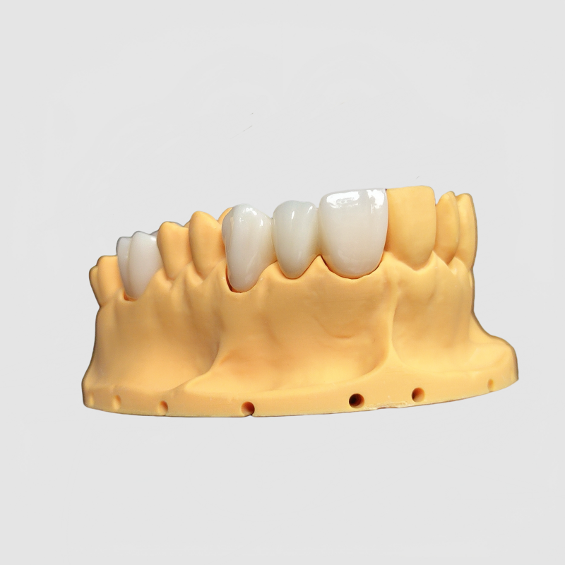 Zirconia Crowns Manufacturer